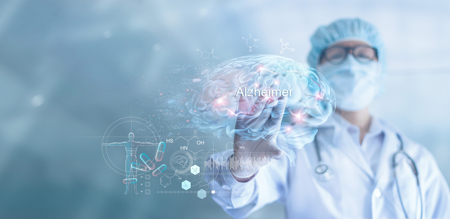 Understanding Alzheimer s Research Prevention and Support at Heron s Key